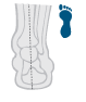 Mild Overpronation