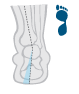 Mild Overpronation